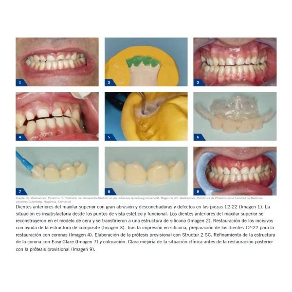 structur-premium-2