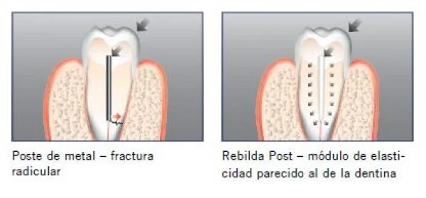 rebilda-post-5